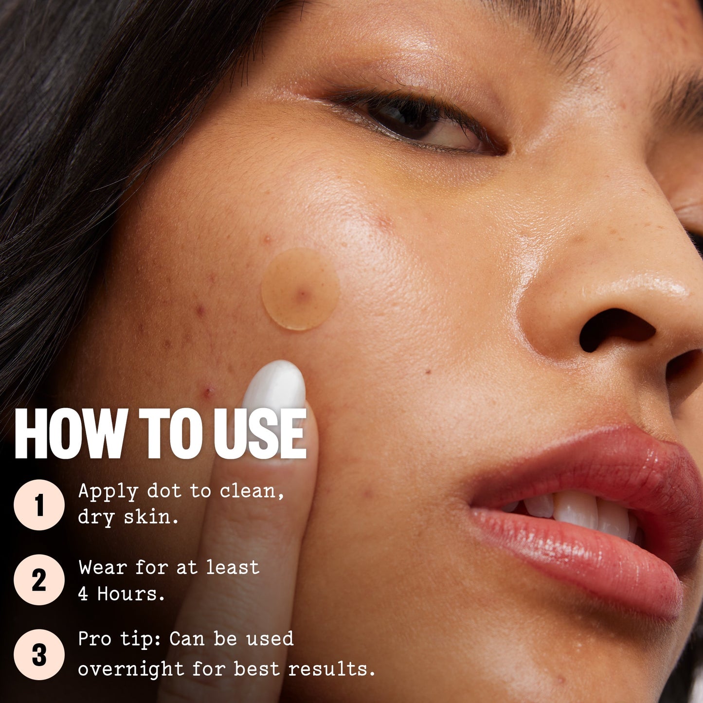 Acne Treatment 20 Dots
